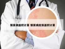 银屑病面积计算 银屑病皮损面积计算