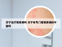 济宁治疗银屑病吗 济宁有专门看银屑病的中医吗