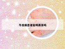 牛皮癣患者能喝黑茶吗