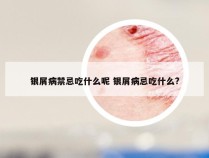 银屑病禁忌吃什么呢 银屑病忌吃什么?