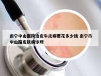 南宁中山医院治愈牛皮癣要花多少钱 南宁市中山路皮肤病诊所