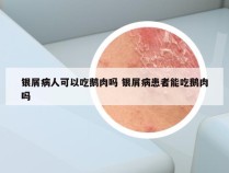 银屑病人可以吃鹅肉吗 银屑病患者能吃鹅肉吗