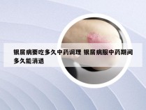 银屑病要吃多久中药调理 银屑病服中药期间多久能消退