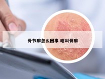 骨节癣怎么回事 啥叫骨癣