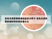 急性点滴型银屑病会起多少疹子 急性点滴状银屑病好转的症状是什么