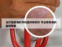 治疗银屑病的专科医院哪家好 专治银屑病的医院哪里