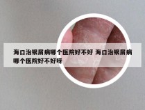 海口治银屑病哪个医院好不好 海口治银屑病哪个医院好不好呀