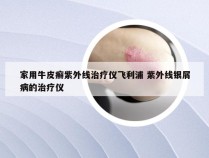 家用牛皮癣紫外线治疗仪飞利浦 紫外线银屑病的治疗仪