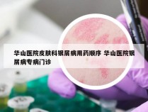 华山医院皮肤科银屑病用药顺序 华山医院银屑病专病门诊