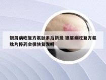 银屑病吃复方氨肽素后新发 银屑病吃复方氨肽片停药会很快复发吗