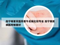南宁哪里家医院看牛皮癣比较专业 南宁银屑病医院哪里好