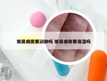 银屑病需要润肺吗 银屑病需要保湿吗