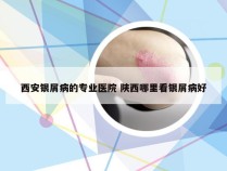 西安银屑病的专业医院 陕西哪里看银屑病好