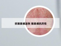 抗银屑病涂剂 银屑病抗药性