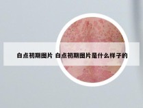 白点初期图片 白点初期图片是什么样子的