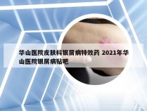 华山医院皮肤科银屑病特效药 2021年华山医院银屑病贴吧