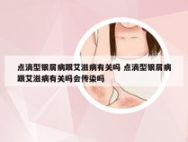 点滴型银屑病跟艾滋病有关吗 点滴型银屑病跟艾滋病有关吗会传染吗
