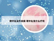 理中丸治牛皮癣 理中丸有什么疗效