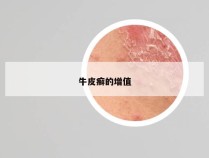 牛皮癣的增值