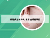 银屑病怎么降火 银屑病缓解妙招