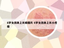 8岁女孩身上长癣图片 8岁女孩身上长小疙瘩