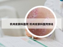 杭州皮肤科医院 杭州皮肤科医院排名