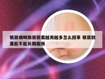 银屑病喝银屑胶囊越用越多怎么回事 银屑胶囊能不能长期服用