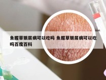 鱼腥草银屑病可以吃吗 鱼腥草银屑病可以吃吗百度百科