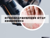南宁银屑病的治疗最好医院是哪家 南宁治疗皮肤病医院哪家好点
