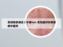 贵阳银屑病咨詢中康hao 贵阳最好的银屑病中医院