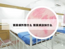 银屑病外擦什么 银屑病涂抹什么