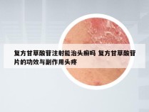 复方甘草酸苷注射能治头癣吗 复方甘草酸苷片的功效与副作用头疼