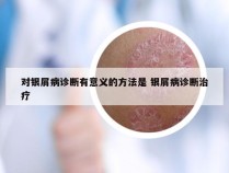 对银屑病诊断有意义的方法是 银屑病诊断治疗