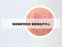 银屑病研究机构 银屑病治疗中心