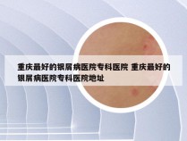 重庆最好的银屑病医院专科医院 重庆最好的银屑病医院专科医院地址
