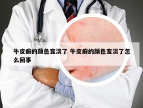 牛皮癣的颜色变淡了 牛皮癣的颜色变淡了怎么回事