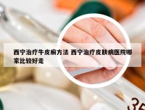西宁治疗牛皮癣方法 西宁治疗皮肤病医院哪家比较好走