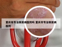 重庆有专治银屑病医院吗 重庆市专治银屑病医院