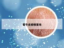 看牛皮癣哪里有