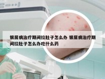 银屑病治疗期间拉肚子怎么办 银屑病治疗期间拉肚子怎么办吃什么药