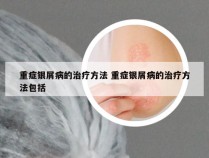 重症银屑病的治疗方法 重症银屑病的治疗方法包括