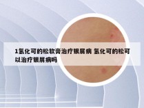 1氢化可的松软膏治疗银屑病 氢化可的松可以治疗银屑病吗