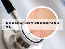 银屑病小红点一般多久消退 银屑病红点会消失吗