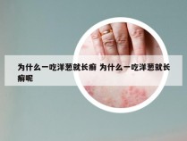 为什么一吃洋葱就长癣 为什么一吃洋葱就长癣呢