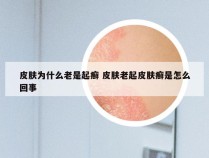 皮肤为什么老是起癣 皮肤老起皮肤癣是怎么回事