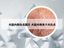 大腿内侧白点图片 大腿内侧有个大白点