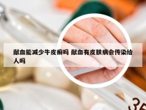 献血能减少牛皮癣吗 献血有皮肤病会传染给人吗