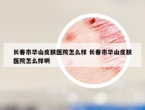 长春市华山皮肤医院怎么样 长春市华山皮肤医院怎么样啊