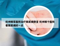 杭州哪家医院治疗银屑病便宜 杭州哪个医院看银屑病好一点