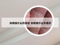 白斑抹什么药膏好 白斑用什么外用药